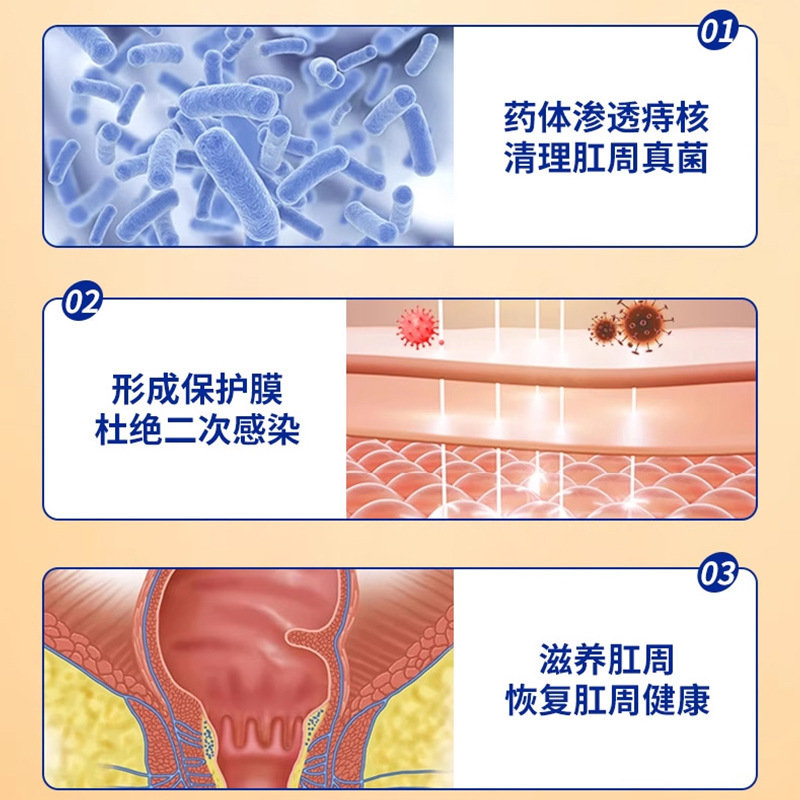 肛門周囲ケア抗菌ジェル痔による不快感外用健康ケア軟膏座りがちな腫れと痛みを和らげる外用健康ケアパッチ|undefined