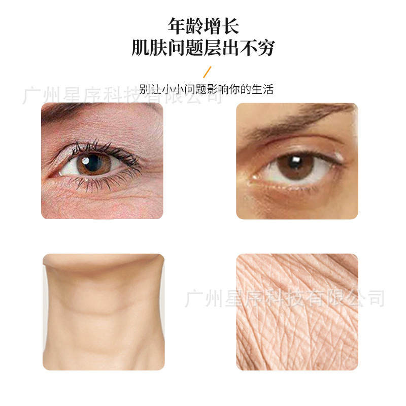 1.0眼周1.5颈纹海体抚平颈纹淡化真性纹改善细纹无胶联玻尿酸工厂|undefined