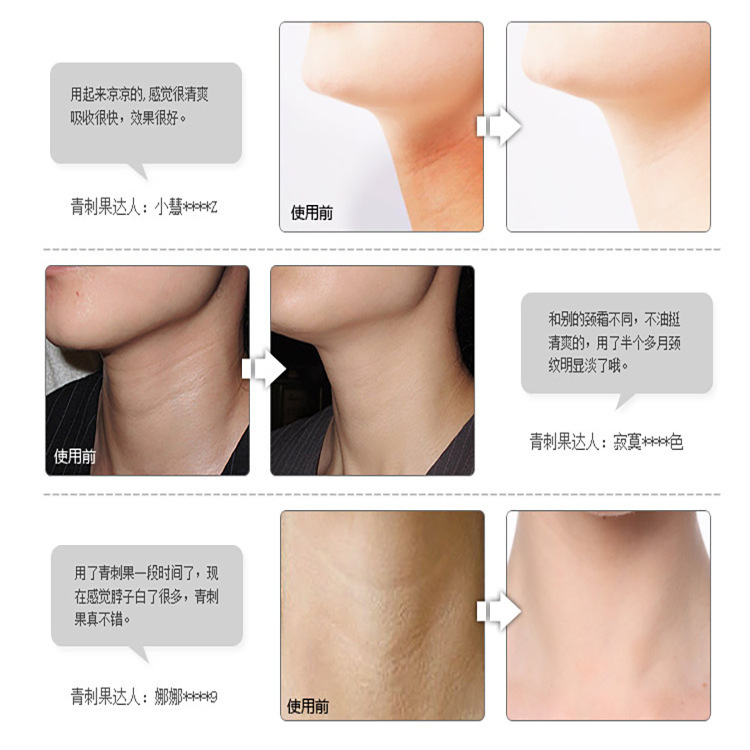 六胜肽颈纹霜淡化颈纹颈部护理提拉紧致补水保湿塑造天鹅颈美颈膏|undefined