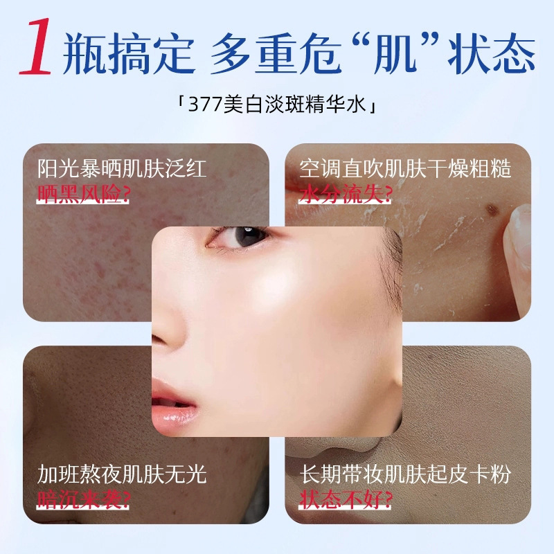 Su Xiuchen の 377 ナイアシンアミド美白とシミ防止エッセンス水保湿、保湿、肌の色を明るくするメーカーによる配送|undefined