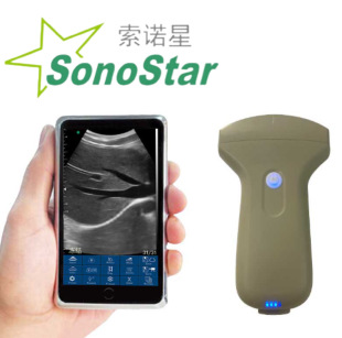 ���Z��Sonostar �S��ֱ�N ͹ꇸ���ϵ�Пo������B��̽�^ ԃ�Ά��r