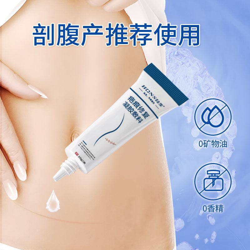 의료용 흉터 드레싱 수술 상처 임신선 흉터 완화 통기성 점착성 흉터 개선 젤 드레싱