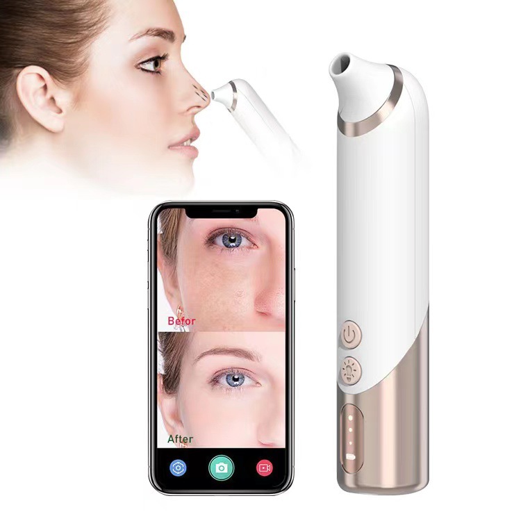 High Suction Blackhead Extractor for Cleansing Pores and Blackheads, New Model Beauty Gadget Household Electric Visual Blackhead Extractor with Microbubble