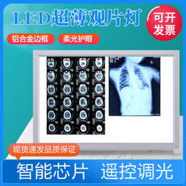 超薄X光观片灯箱医用led看片灯箱阅片灯三联看观片灯双联骨科核磁