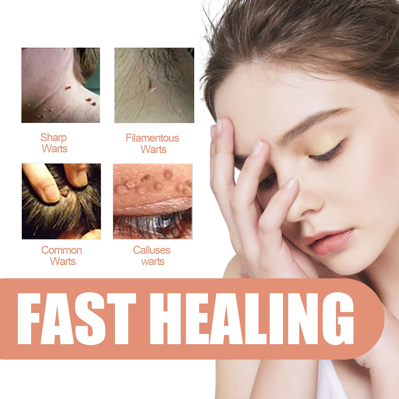 EELHOE for skin repair, body care, hands, feet, face, and underarm wart cream_voghion.com
