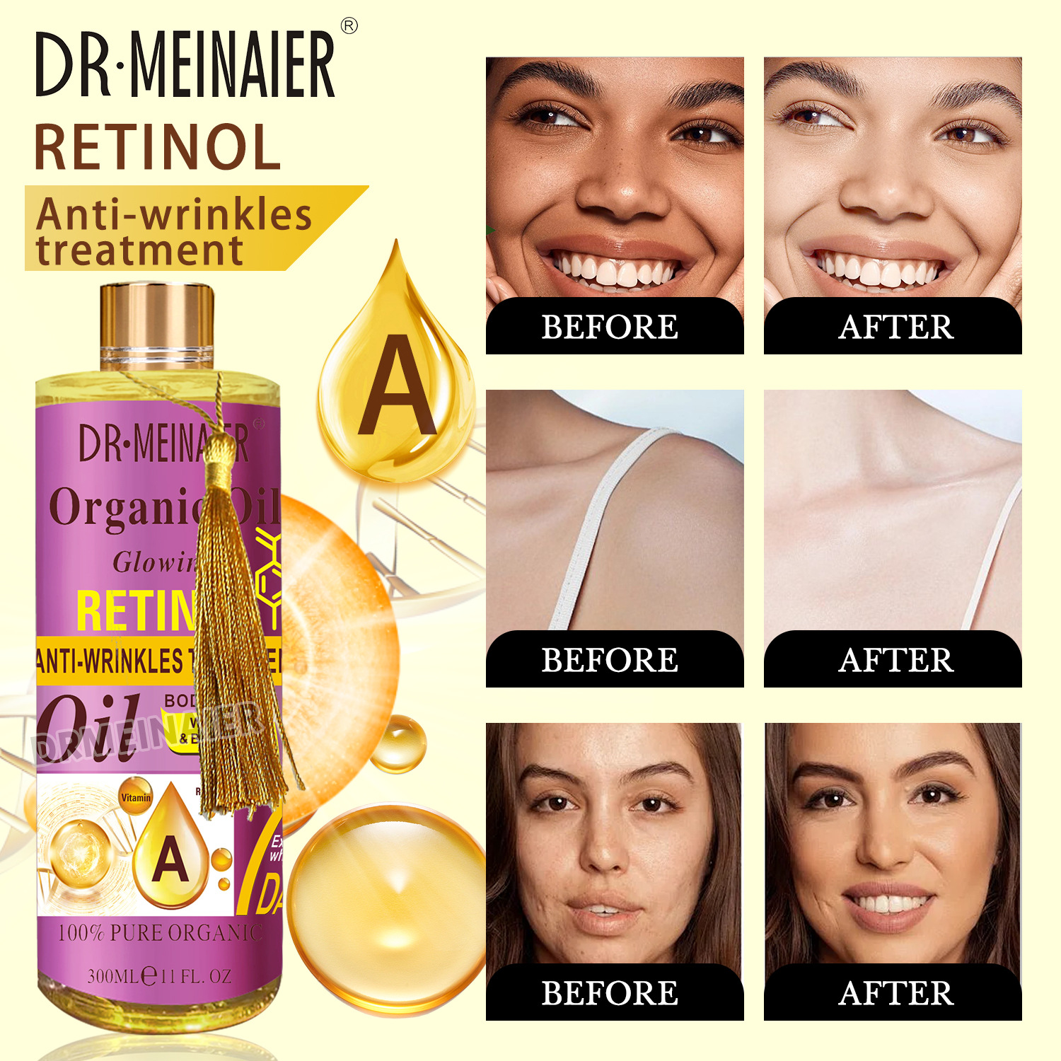 retinol