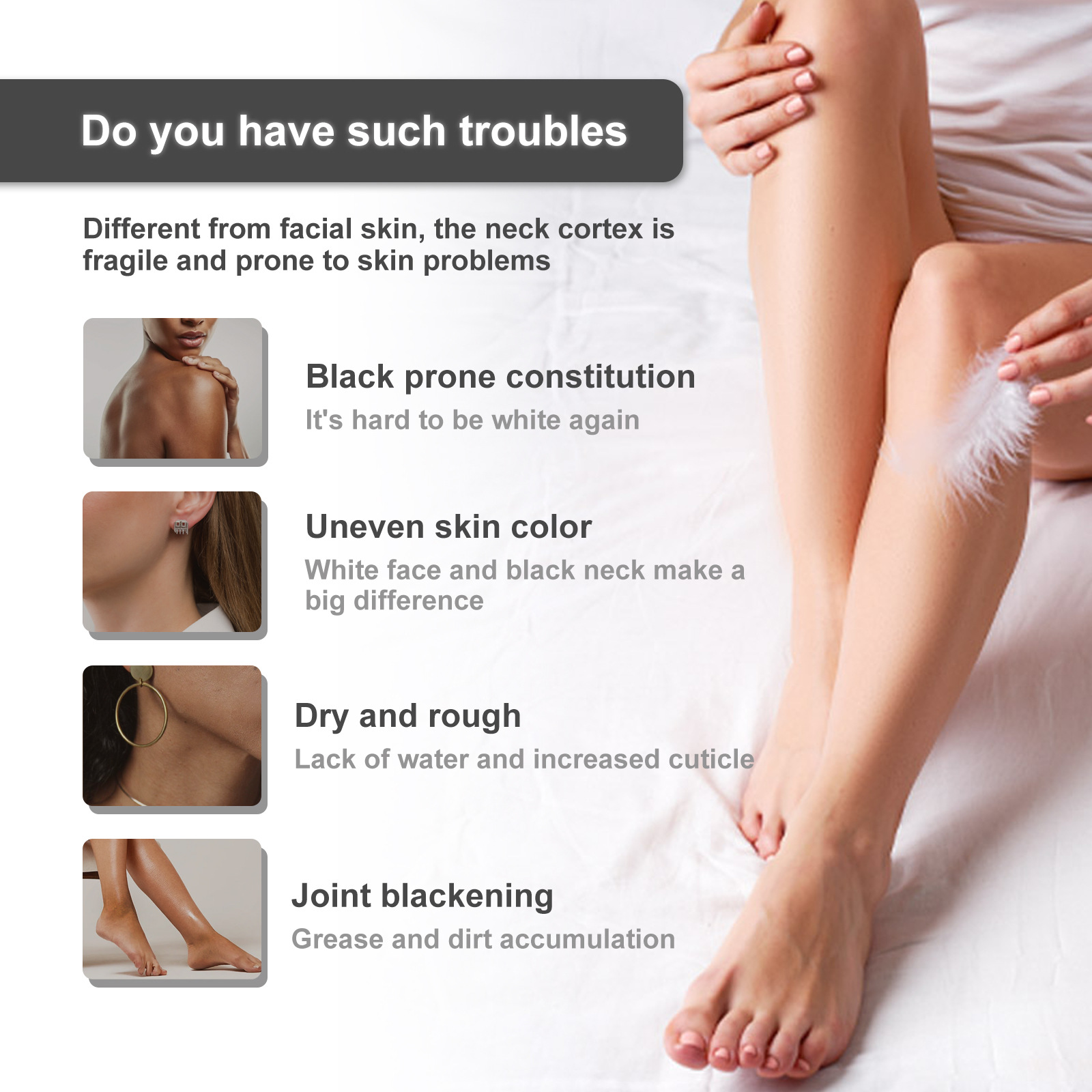 OUHOE répare la noirceur des articulations du coude, éclaircit le teint, hydrate, blanchit et nourrit la crème de beauté de la peau_voghion.com