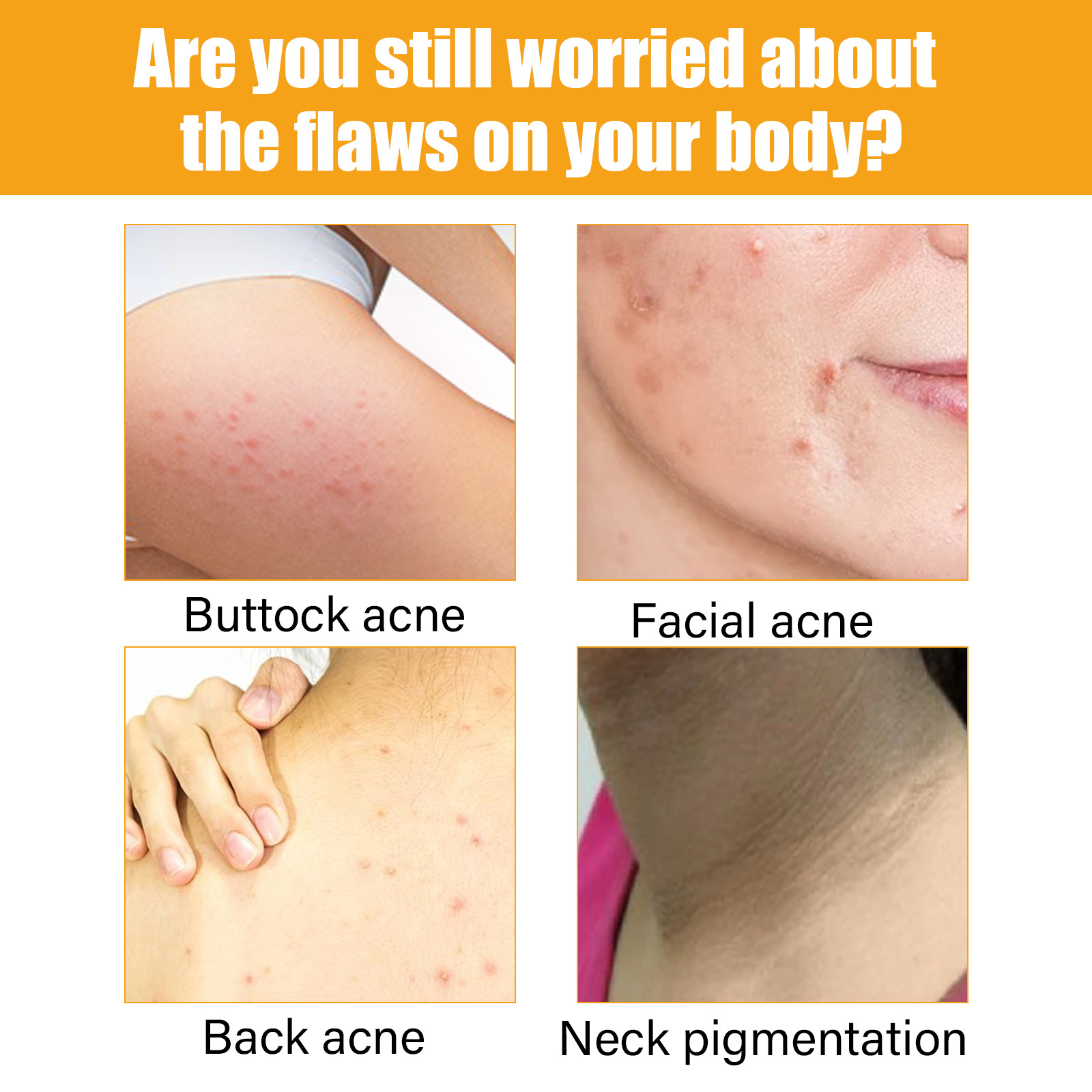 Jayusing Anti Cream Lighten and Acne Marks Esencja do nawilżania i naprawy skóry na ustach_voghion.com