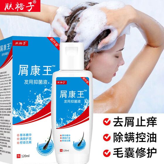 Shampoo Kangwang Antipruritic and Anti-dandruff Repair Shampoo Refreshing Head Oil Mite Mite Head Moss Head Itching Selenium Disulfide Wash