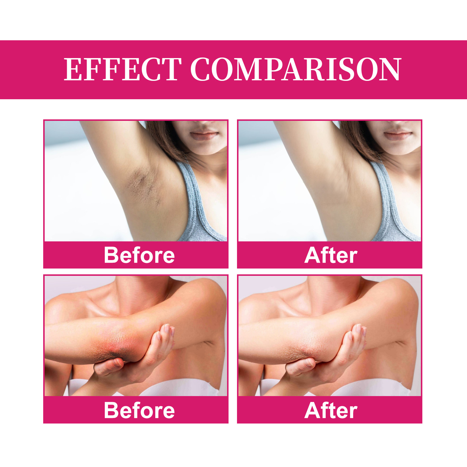 OUHOE underarm skincare cream for removing blackness, brightening skin tone, moisturizing and whitening_voghion.com