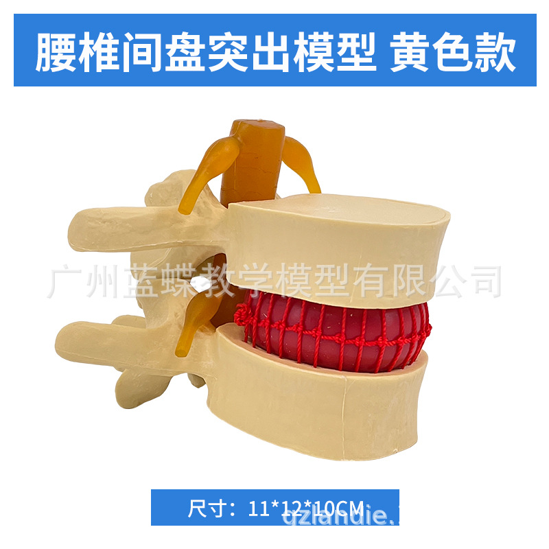 ׵����ģ����Ʒҽѧ������׵ͻ��������׵�ǲ�����ʾ�ؽڱ�׼ģ��