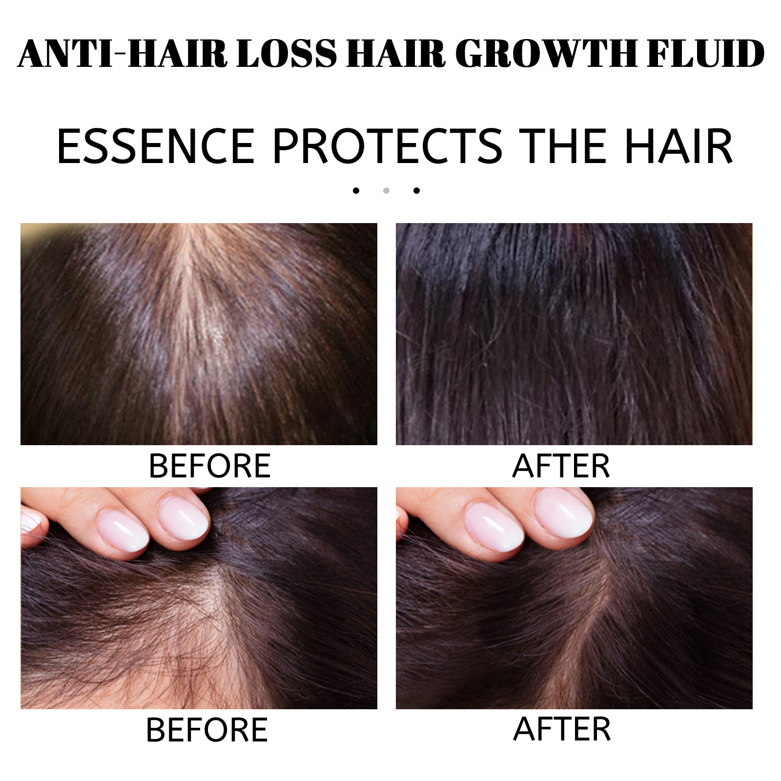 EELHOE Hair Growth Serum4