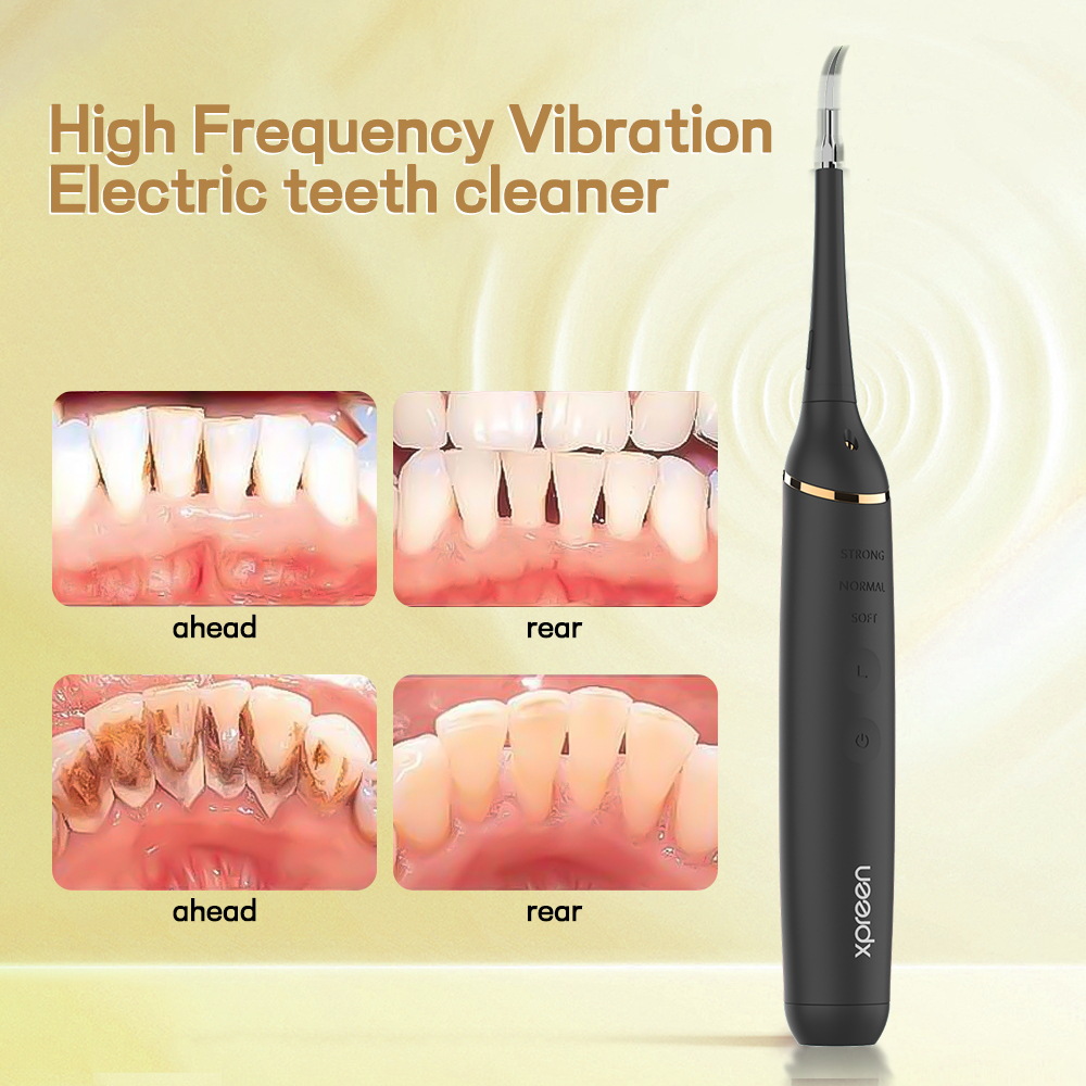 Sonic Toothbrush Image 4