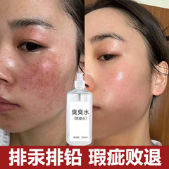 臭水、スルフィド水、鉛・水銀除去、そばかす・肝斑除去、ホルモン改善、顔の美白、美容液、エステサロン