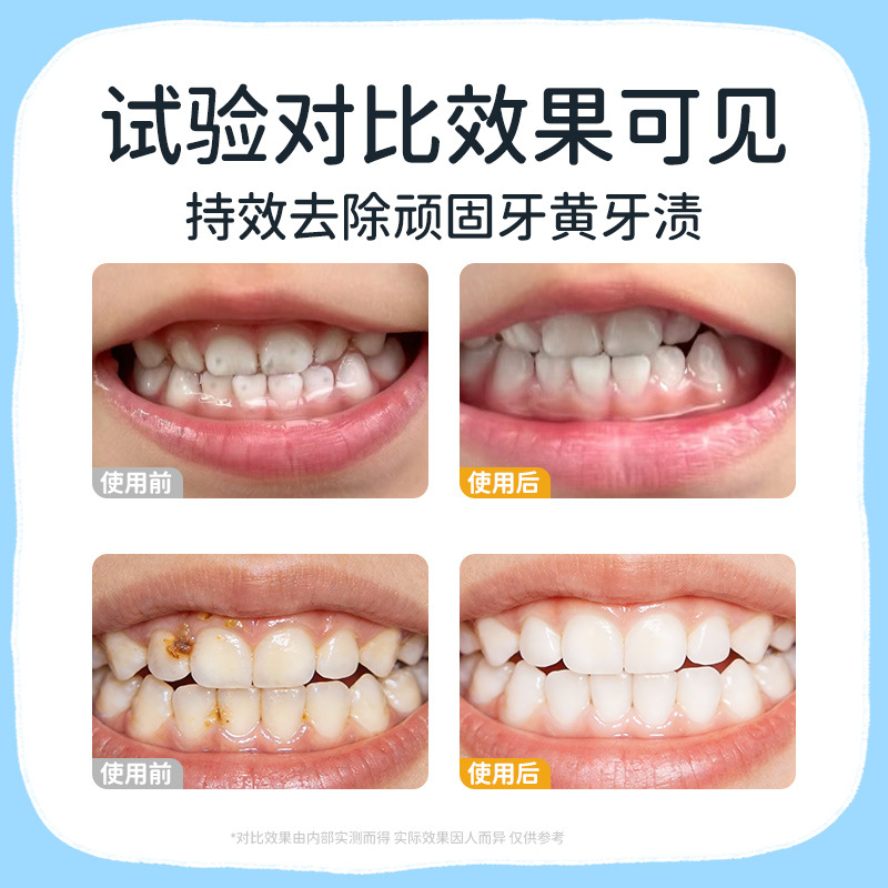 Babag anti-cavides de azúcar, esmalte protector, pasta de dientes de color, aliento limpio, protector de dientes anti-cavides de dientes para niños. image 3