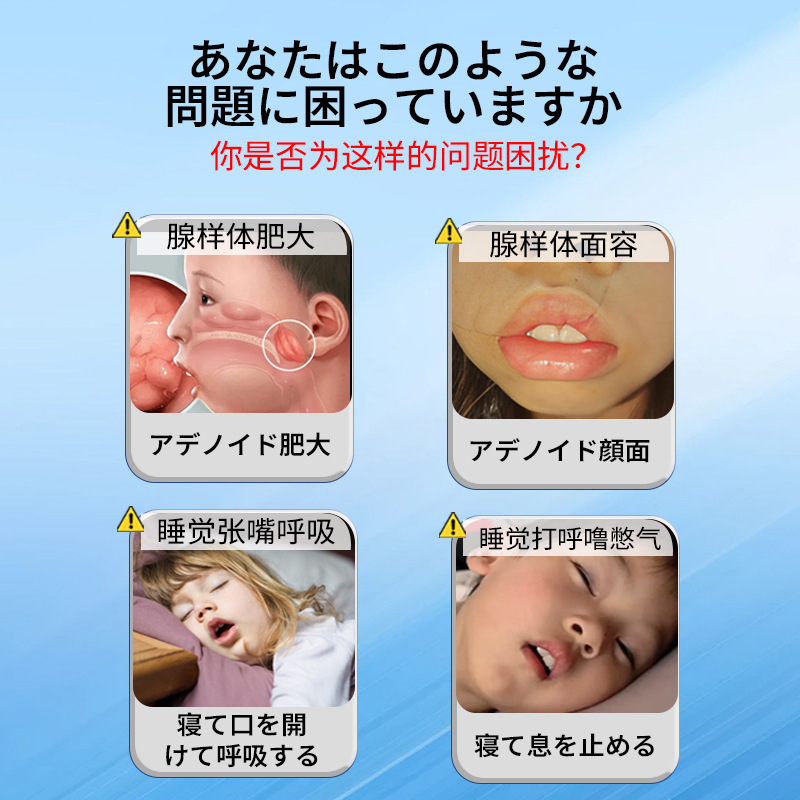 小児アデノイドパッチ、開口睡眠、開口呼吸ケア、鎮静ヘルスケアパッチ、小児アデノイド肥大軟膏パッチ|undefined