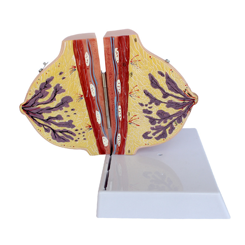 �鷿ģ����ģ���ز�����ģ�;�ֹ�ڲ�����Ů���鷿�ṹ��ҽѧ��ѧ