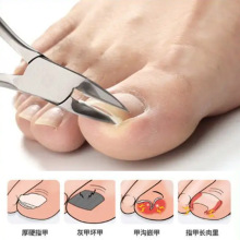 �޼׹��߲��P��޼�ָ�׼ל�Ƕ����Ƥ�Q�m��Ӳ�׺��ָ�׼������l