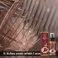 OUHOE ätherisches Zwiebelöl dichtes, starkes, festes, feuchtigkeitsspendendes Haarpflegespray_voghion.com