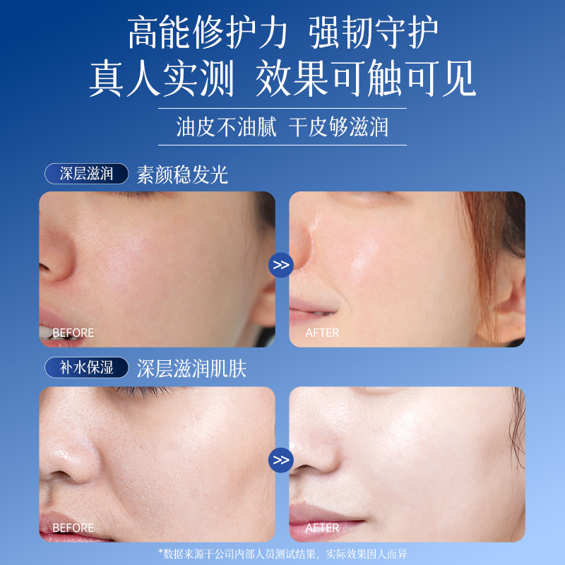 洛娅维生素原B5舒润特护霜补水保湿防干裂清爽不油腻保湿面霜秋冬|undefined
