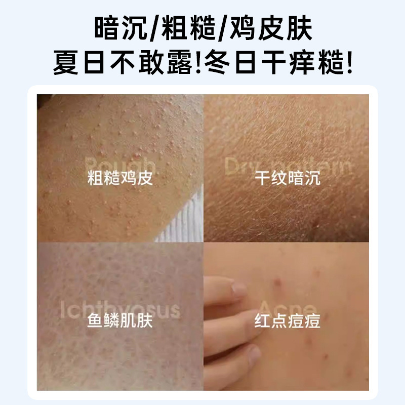 Dr. Spring フルーツ酸 VE 尿素クリームは鶏の皮を改善し、キューティクルを柔らかくします。 ビタミン E 尿素クリーム保湿ボディローションカスタマイズ|undefined