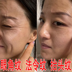 断纹液提拉紧致去皱抗初老去法令纹细纹眼纹六胜肽原液抗皱精华液