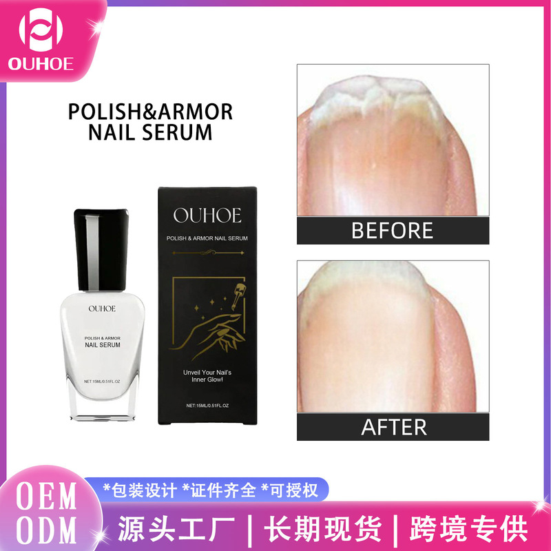 Ouhoe Nail Care Solution Gentle Care for Hands and Feet, Brightens and Moisturizes Nail Surface, Protects and Cares for Nails, Refreshing Care Solution
