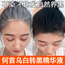 ���מ����D�ھ��AҺ�װl�B�ڰlԭҺ���Bë�����L�lҺ��Ó���lҺ