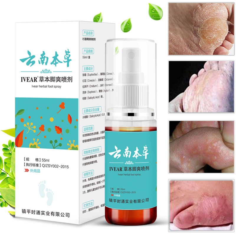 Yibao Yunnan Herbal Foot Antifungal Spray Foot Antifungal Herbal Foot Odor Spray Foot Odor and Sweat Spray