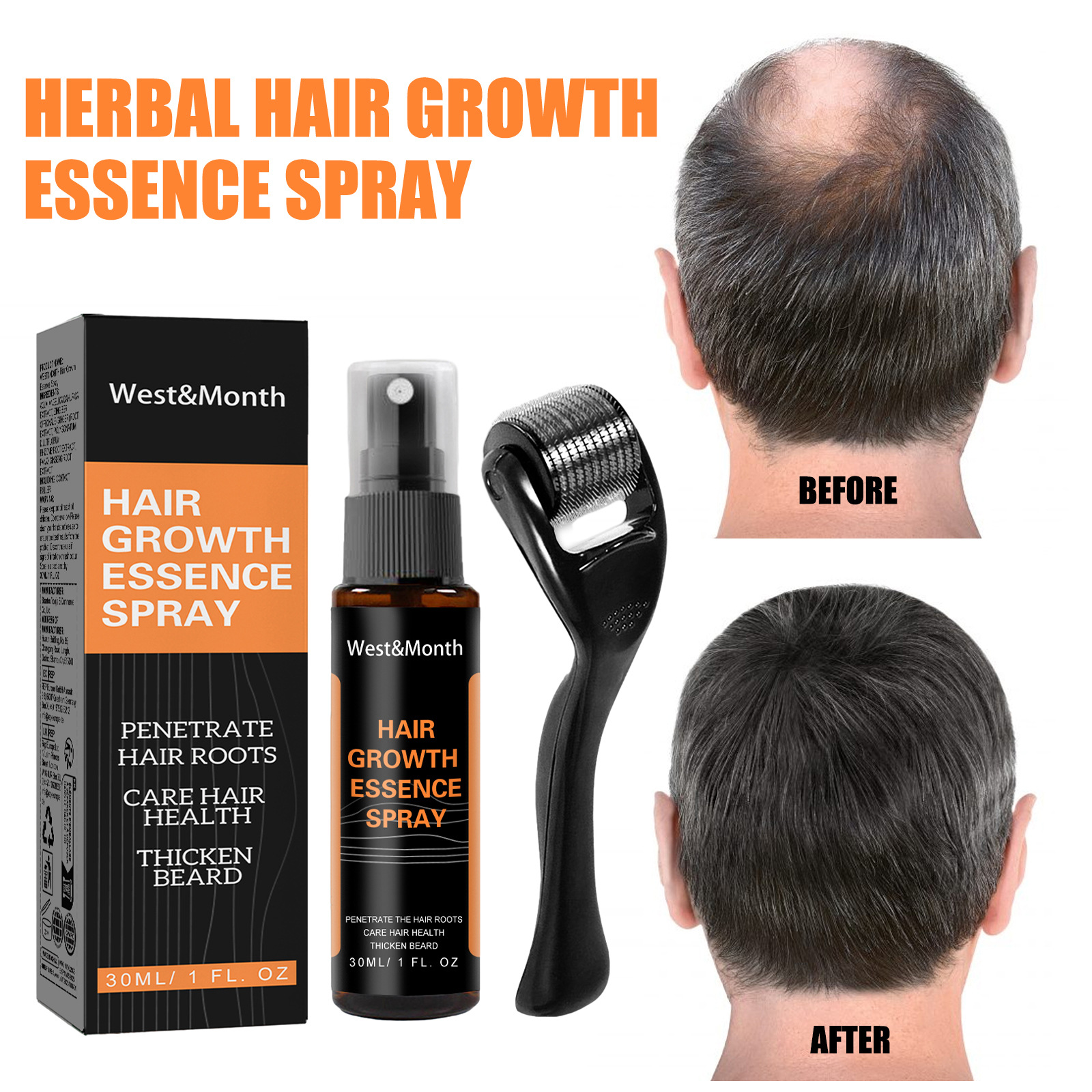 Cross-Border Direct Sales West Month Hair Spray Set Polygonum Multiflorum and Ginger Gentle Scalp Care Spray