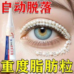 ドイツ輸入KG脂肪粒除去神器汗管粒眼部除去油脂目尻顆粒清筋潤霜