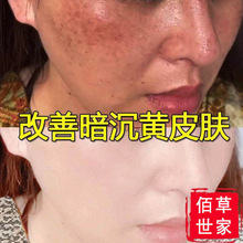 佰草世家亮白补水保湿祛印暗黄抗皱嫩白精华水液收缩毛孔原液