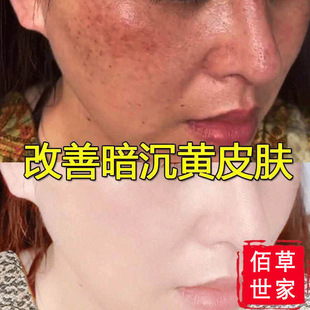 �۲����������aˮ������ӡ���S�����۰׾��AˮҺ�տsë��ԭҺ