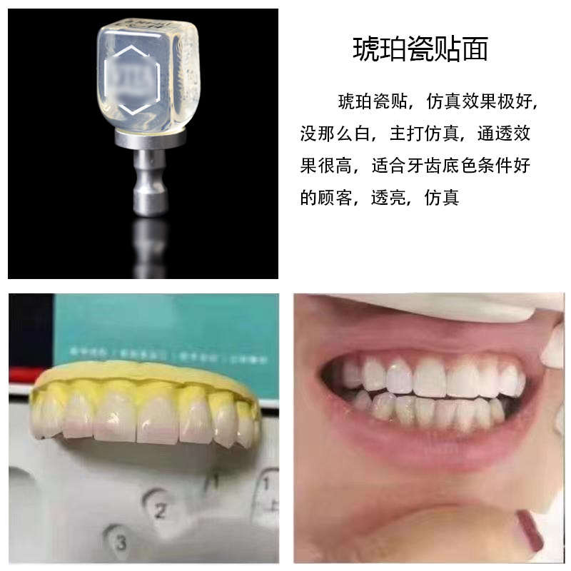 Tiras blanqueadoras de dientes, dientes de porcelana privados, porcelana azul, porcelana ámbar, enseñanza y formación para estudiantes, carillas totalmente cerámicas