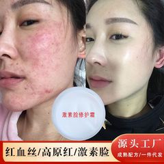 ホルモンの顔の保護クリームは赤い血の糸に行って赤くなります。