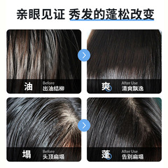 Han Lun Meiyu's oil-removing, dry and fluffy powder, oil head artifact, oil-controlling bangs fluffy powder, natural dry, oil-removing loose powder