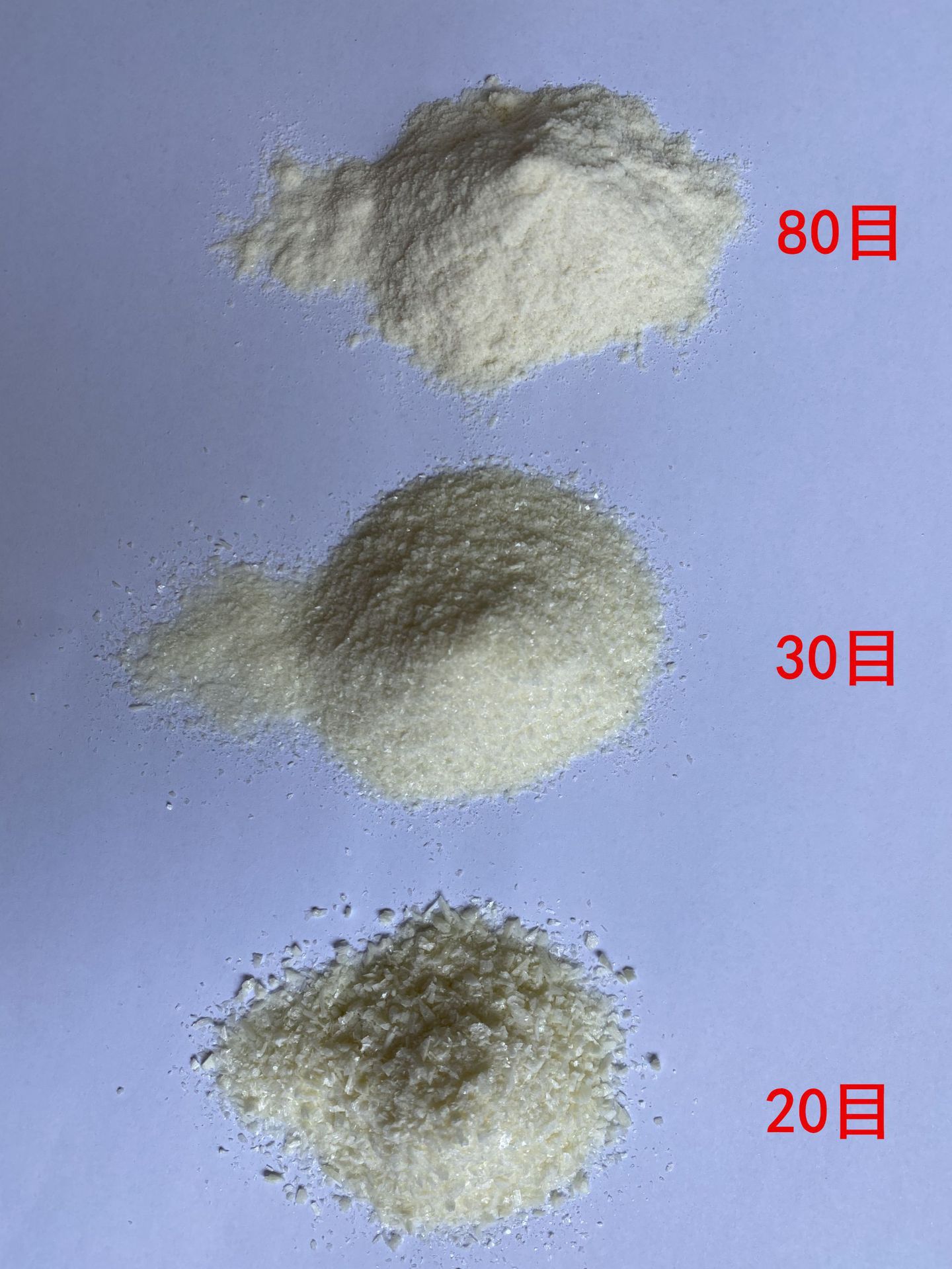 면역 글로불린 IGG20 %