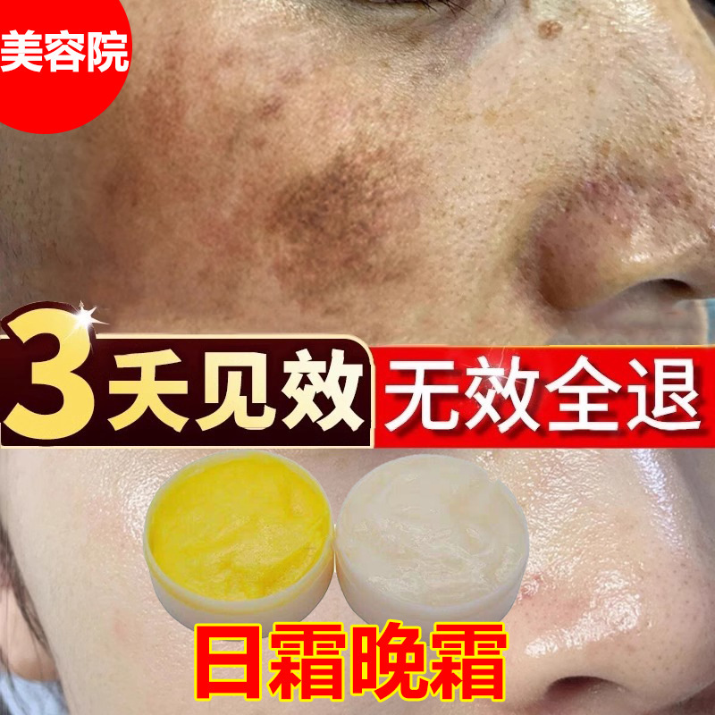 美容院の日霜晩霜はシミクリームを取り除いて美白して黒色の色素に行って老人のぶちに行って色のぶちを淡々としてそばかすことができます。|undefined
