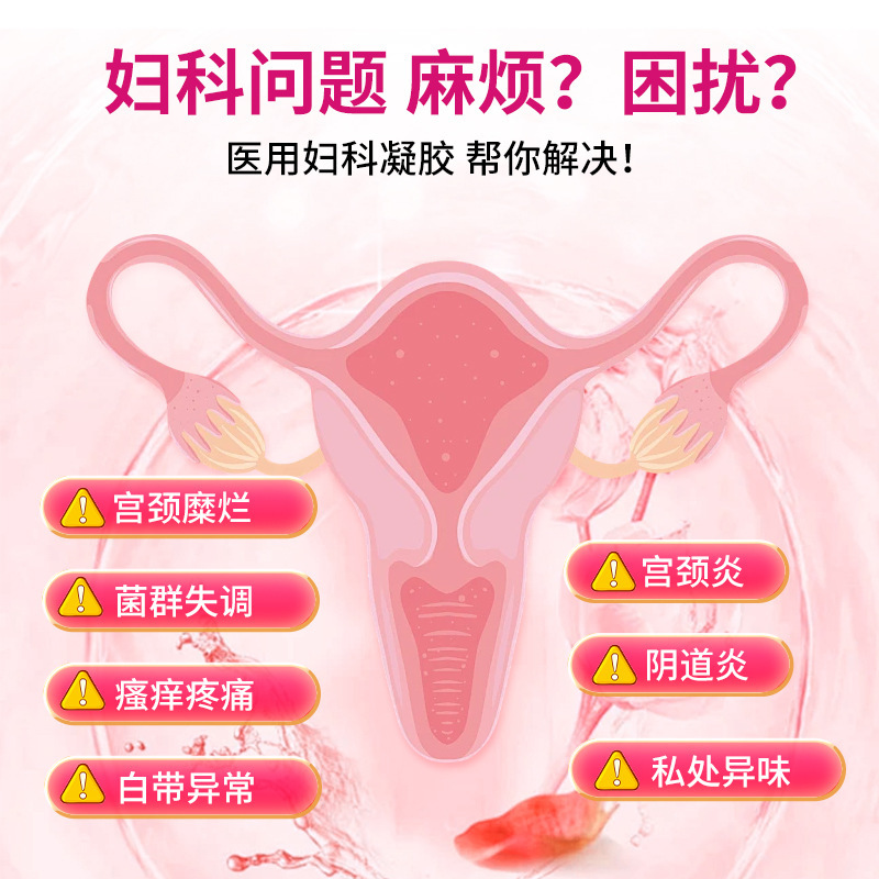 女性の陰部のケアとメンテナンスのための修正された医療用婦人科ジェル、ピンクで引き締まった肉芽、子宮頸管の潰瘍、抗菌ジェル|undefined