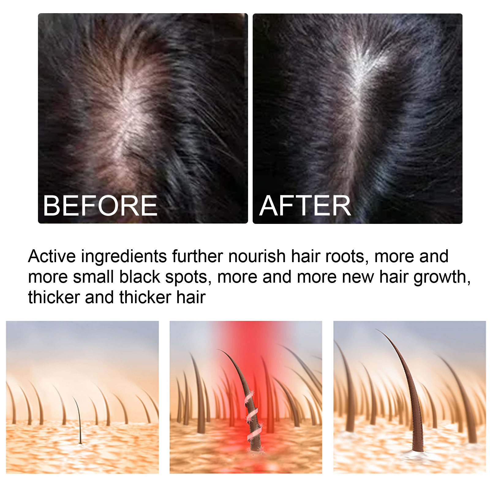 EELHOE Dense Oil Thickens Firms Hair, Nourishing Repairing Roots, Caring for Strong and Tough Hair_voghion.com