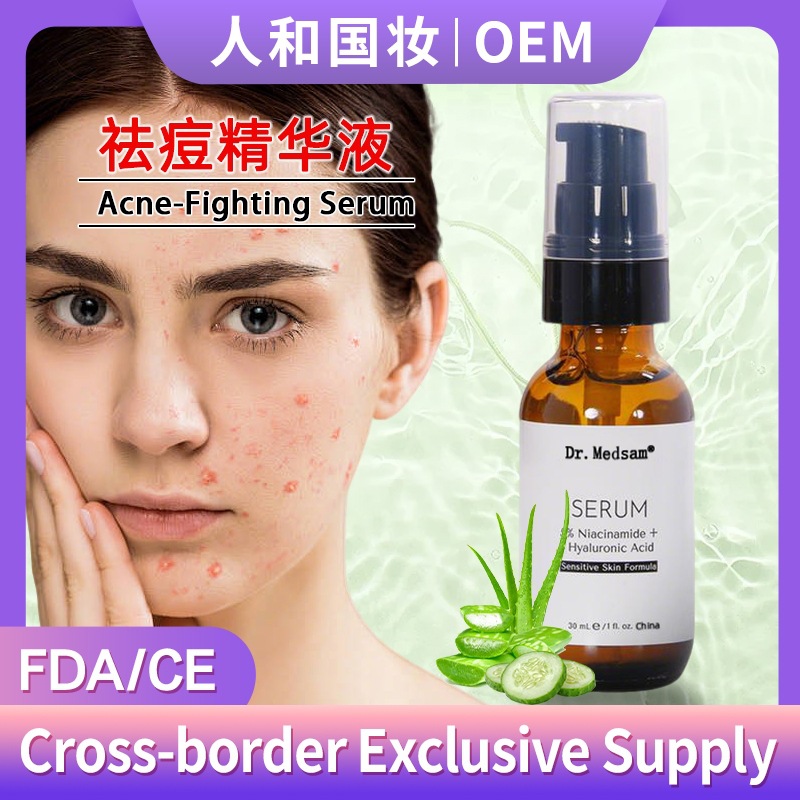 菲律宾爆款5%烟酰胺去痘精华液修复敏感红肿痘印熊果苷祛痘水跨境