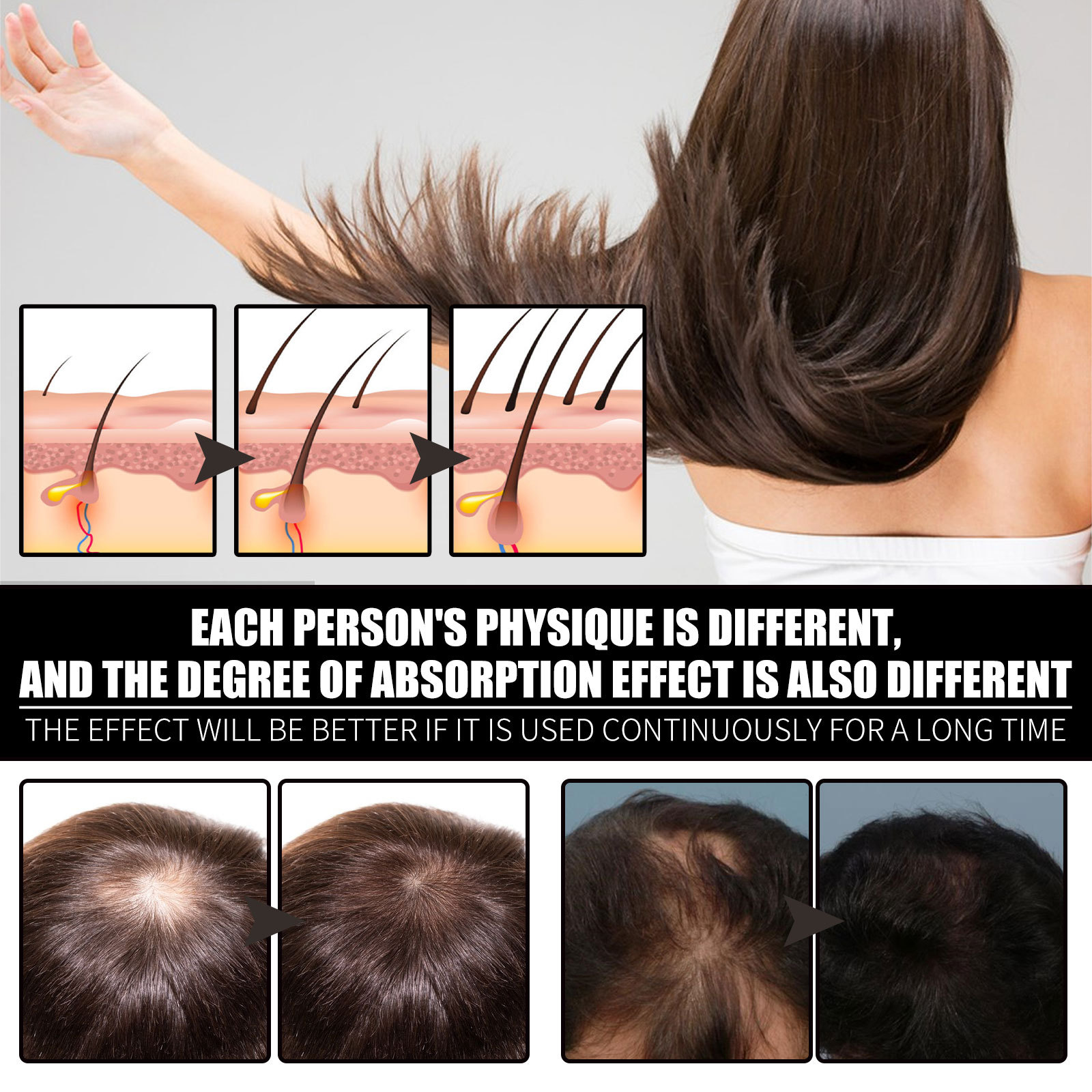 OUHOE Collagène B7 Vitamine Croissance Huile Essentielle Dense, Raffermissante, Anti-Casse et Soin Capillaire_voghion.com