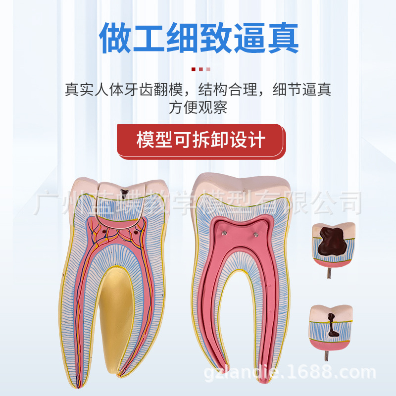 ���ƿ�ǻ�ı�ȣ�ݷֽ�ģ�� ����������ʾȣ�ݷ�չ���� ҽ����ͨ