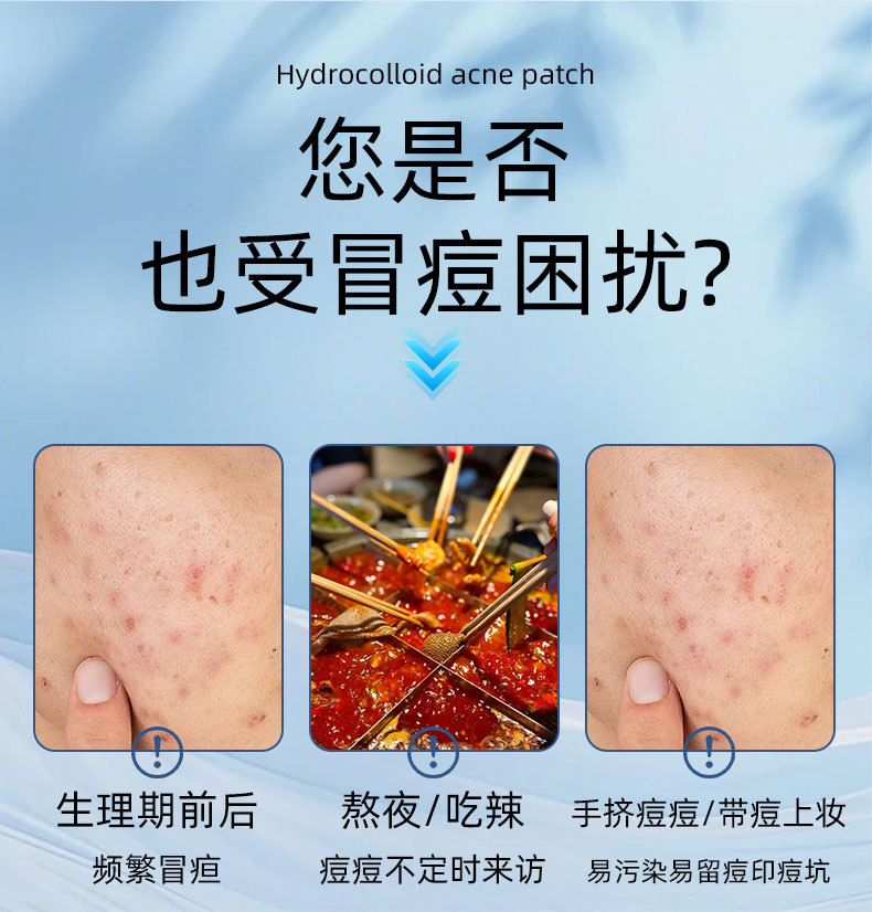 Acne Patch Transparent Round Hydrocolloid Sticker Pimple Patch Salicylic Acid PE Star Pus-Absorbing Invisible Acne Patch