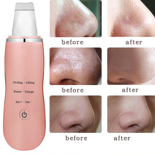 Pore Cleaning Facial Cleanser Electric Hot Compress Massage Facial Cleanser Cosmetic Equipment Cross-border Electric acne blackhead cleansing