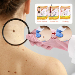eelhoe spot mole and wart essence, skin, face, armpits, neck removal, repair, cleaning and care