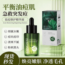 �A��С�Gƿˮ��������AҺŮ�ЌW�����͸��ƶ����澏ԭҺ�o�wƷ