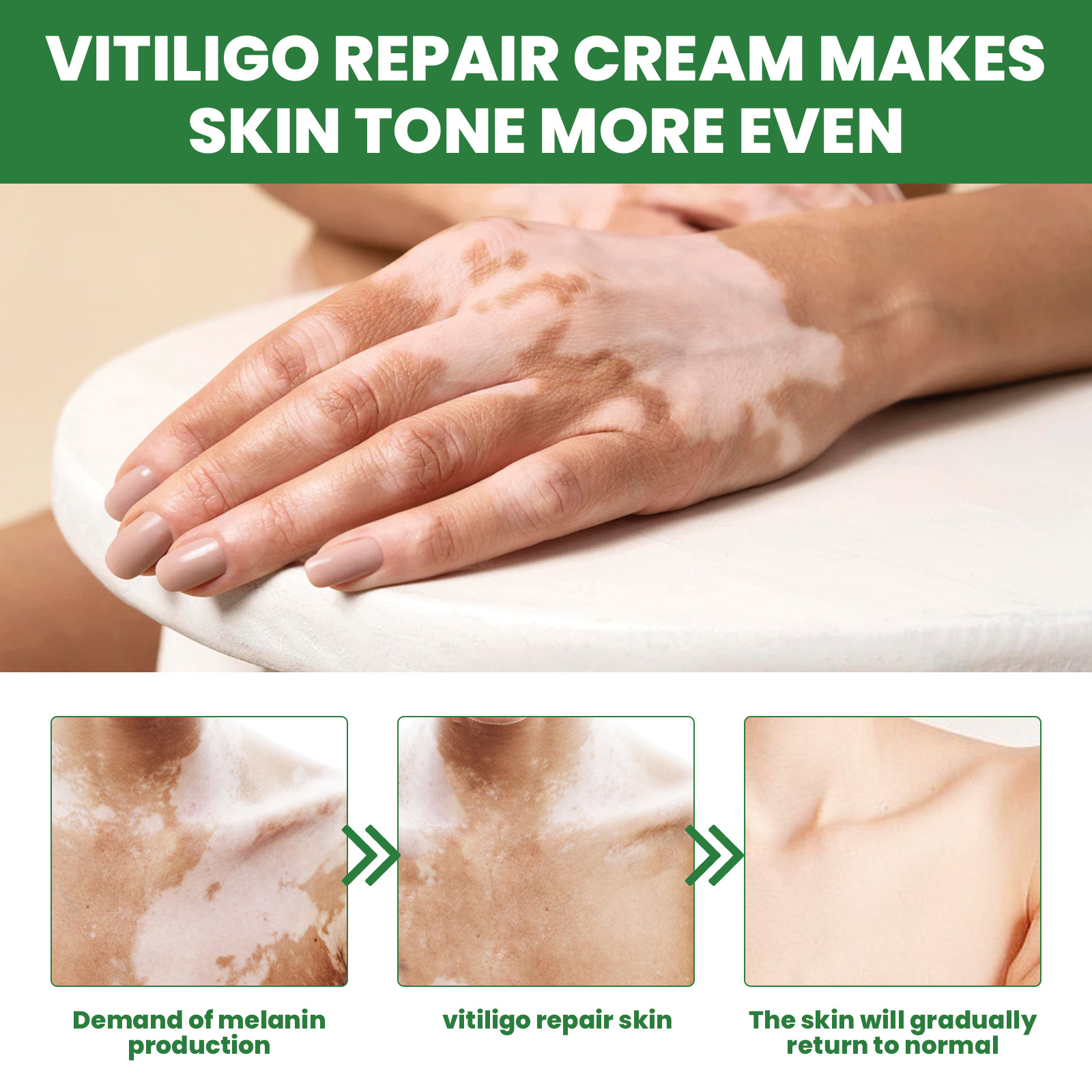 EELHOE Crema riparatrice per applicazioni esterne desalinizzante per macchie di fiori bianchi e pelle di mani e piedi_voghion.com