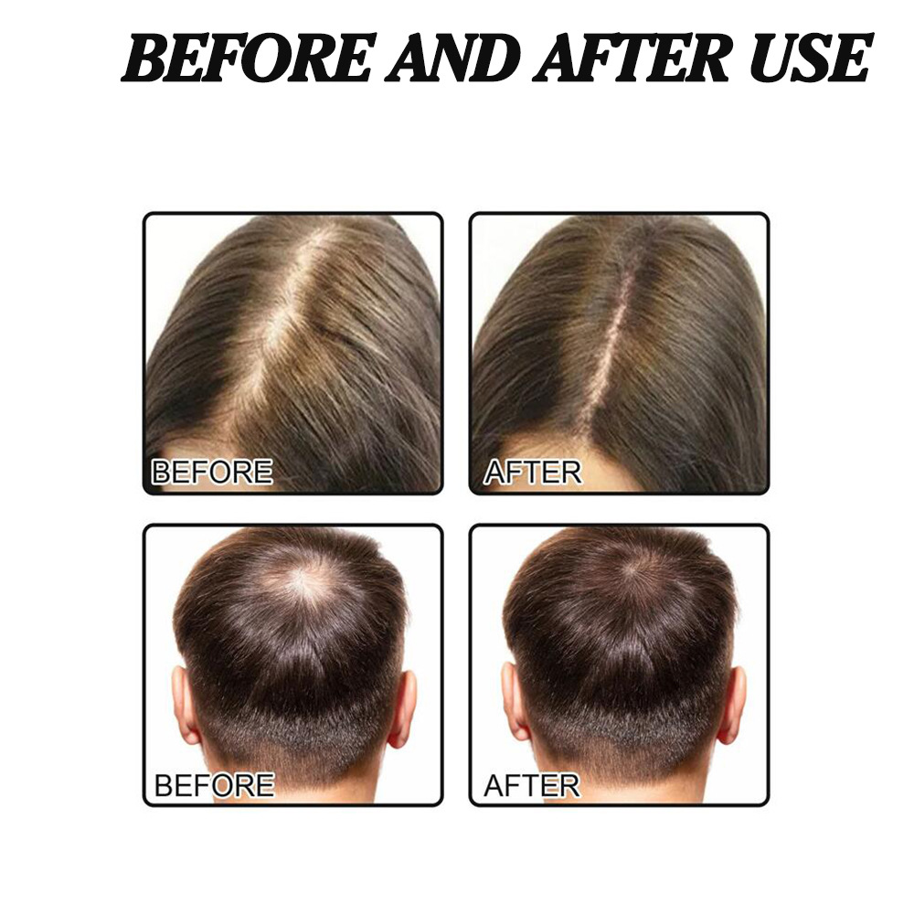 Haar Kopfhaut trocken und beschädigt Reparatur Haarpflege Glättung ätherisches Öl_voghion.com