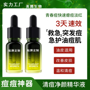 �N��С�Gƿqu�����AҺ�沿�ֶ����A�Ͷ������͌��ô���OEM�羳